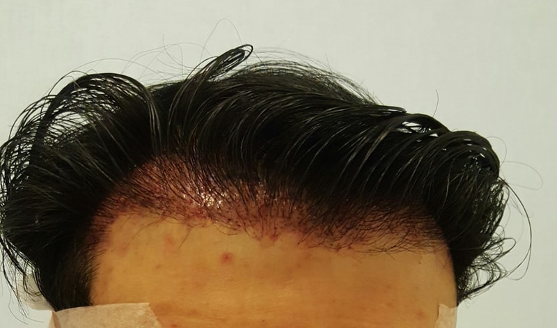 재수술.jpg