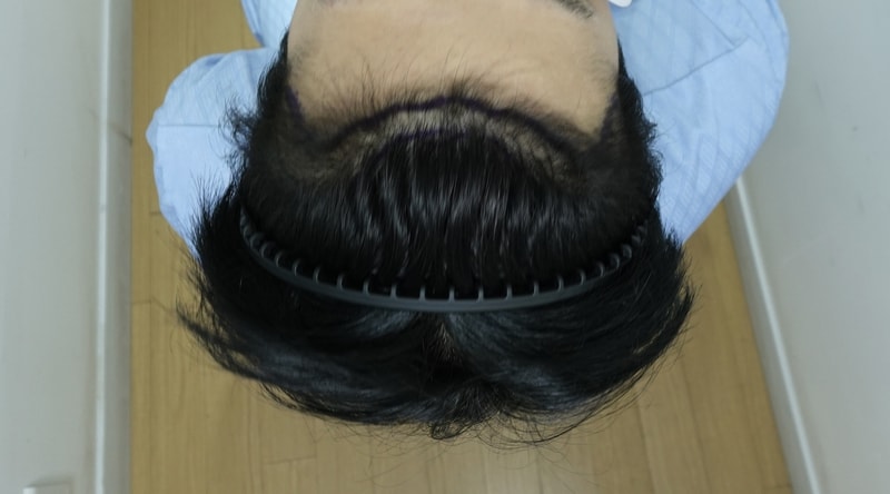 전 위.jpg