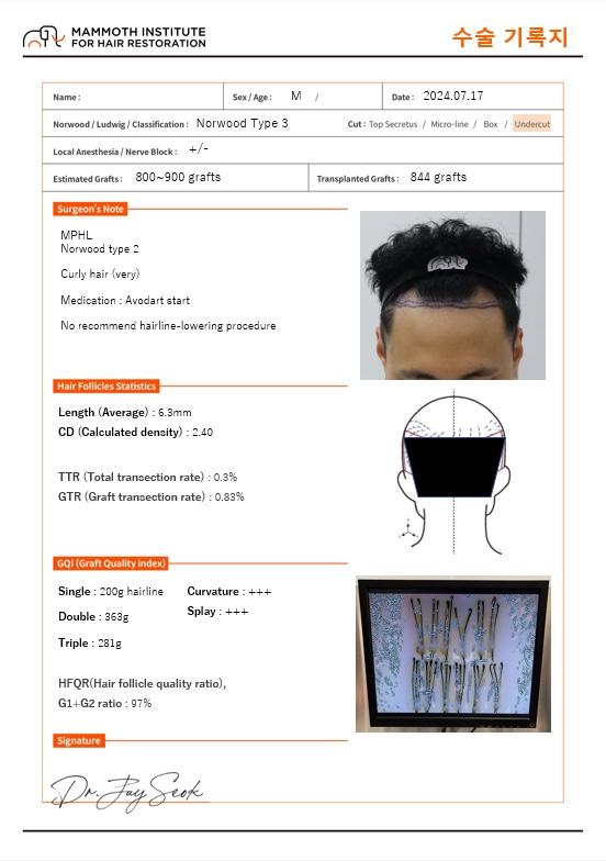 Apgujeong Mammoth Hairline Clinic Men's M-shaped Non-Cutting Hair Transplantation Day 1 Review