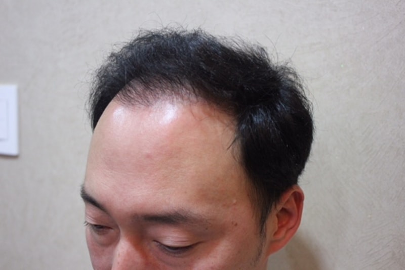 수술전-2.JPG
