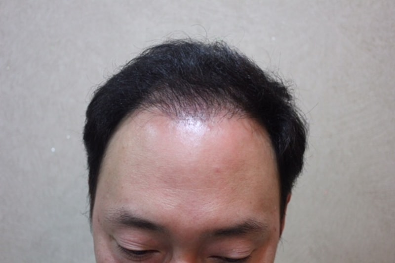 수술전-3.JPG