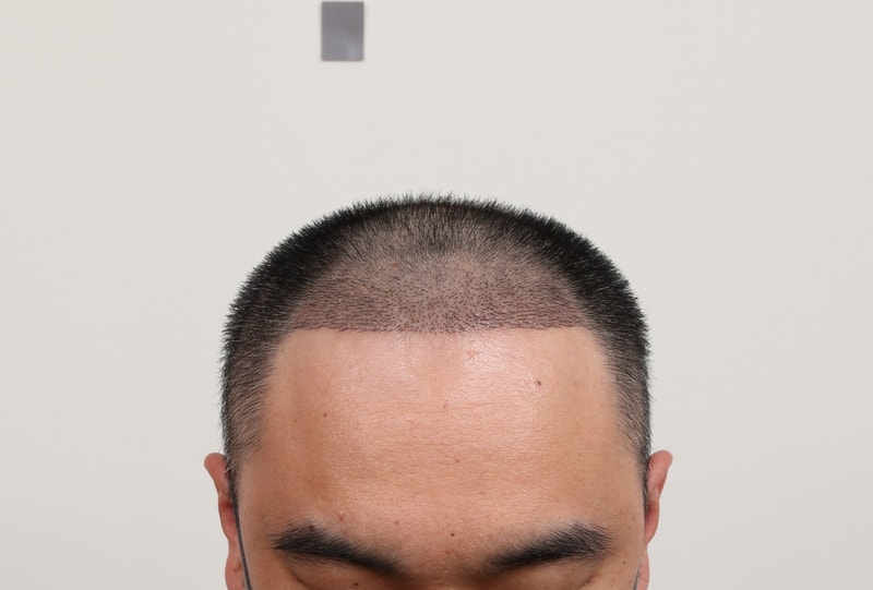 1000012614.jpg
