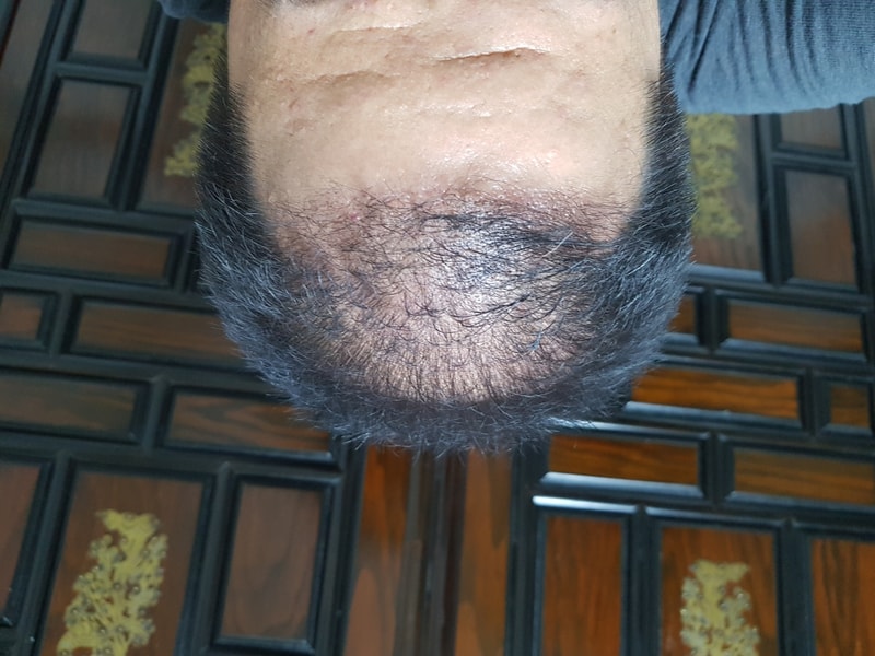 20180923_222401.jpg
