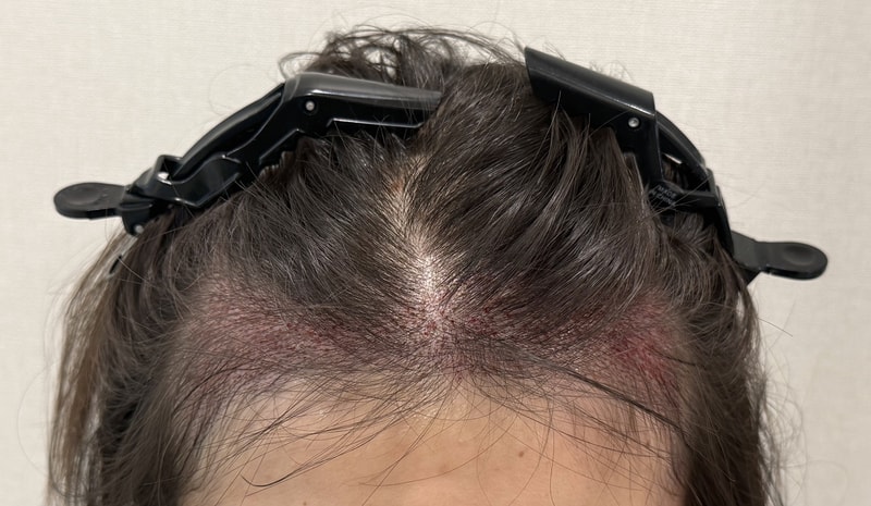 포토후기 이미지