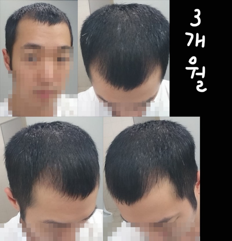 8월말_3개월차.jpg
