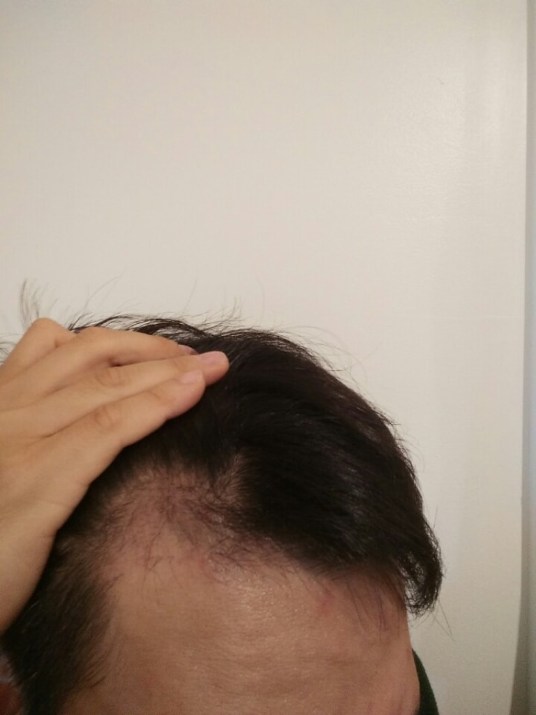 2달후.jpg
