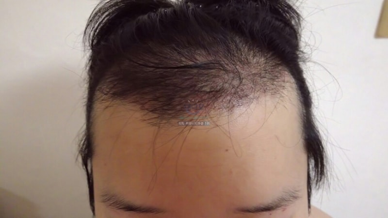 2개월.jpg