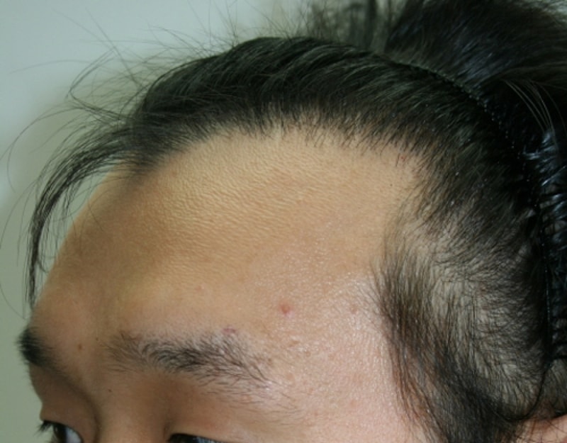 gf20150810_105426.jpg