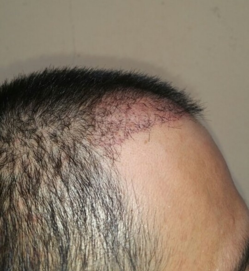 ポヘアの一ヶ月間の評価ですが、私のこと覚えていますか