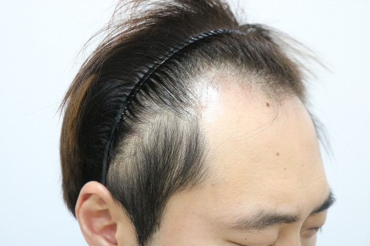 초진-왼쪽.jpg