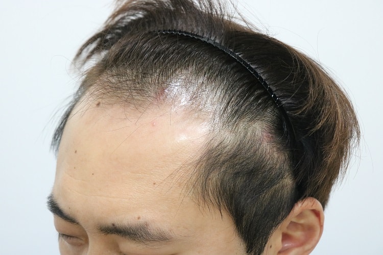 초진-오른쪽.jpg