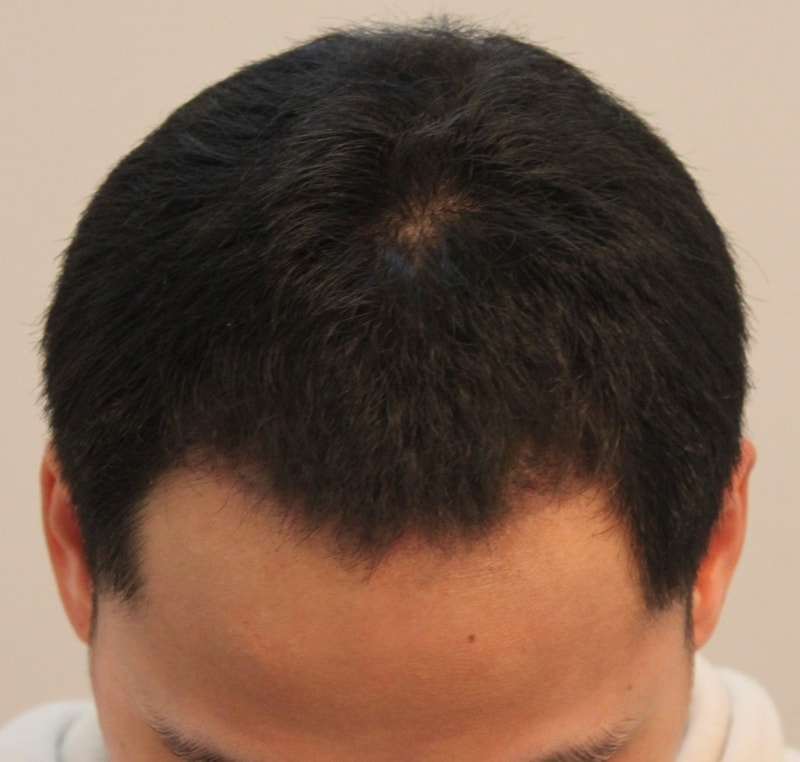 3달1.JPG