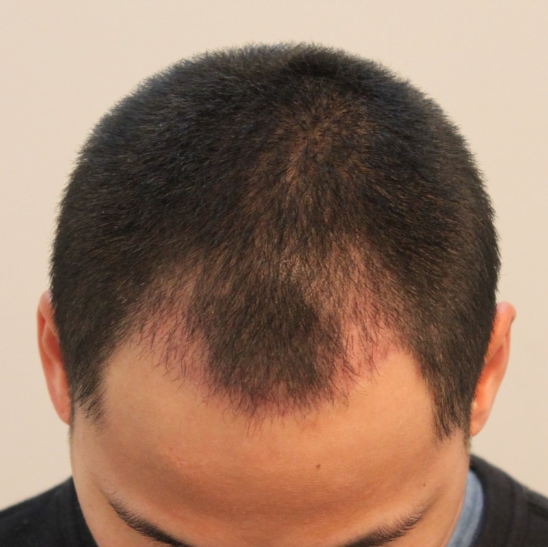 1달1.JPG