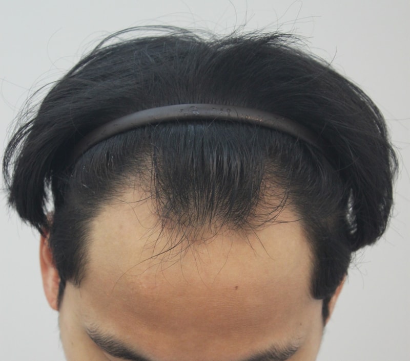전1.JPG