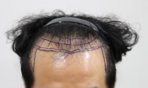모자이크_정.JPG