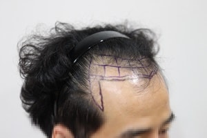 모자이크_오.JPG