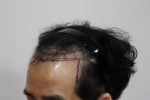 모자이크_왼.JPG