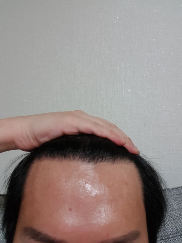 후1.jpg