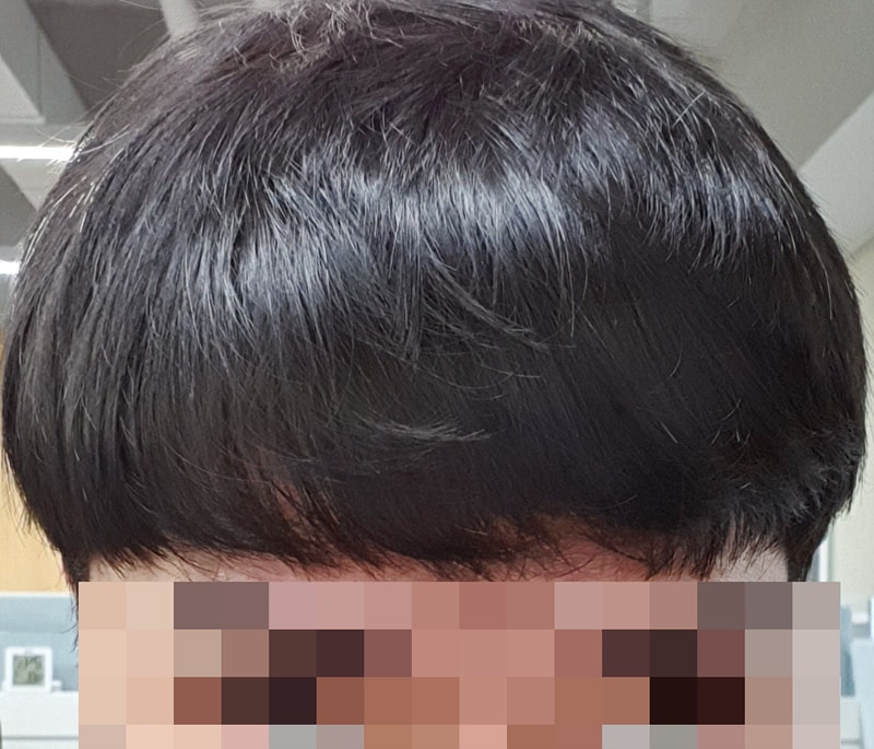 front_normal.jpg