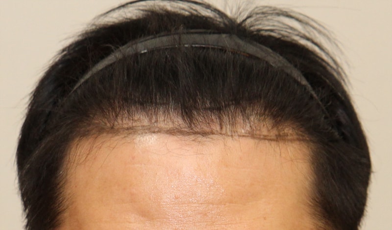 front_before.jpg