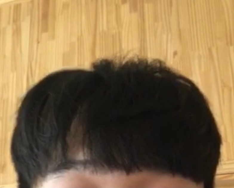 암흑기 덮머리중.png