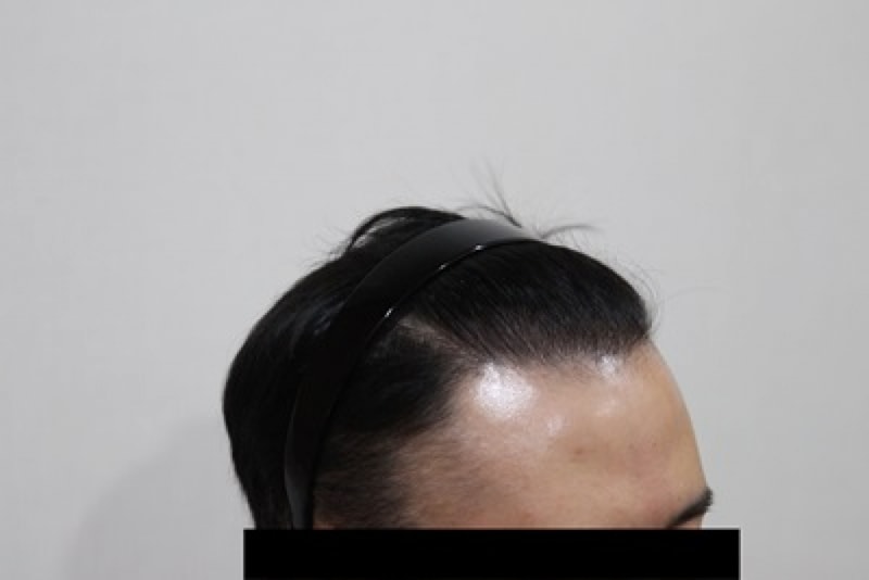 ㅇㄱ009-20170510-153716.JPG