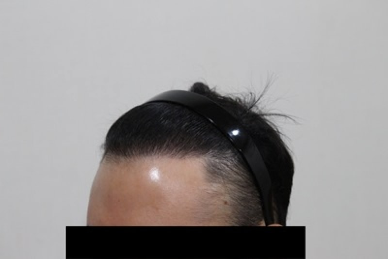 ㅇㄱ008-20170510-153709.JPG