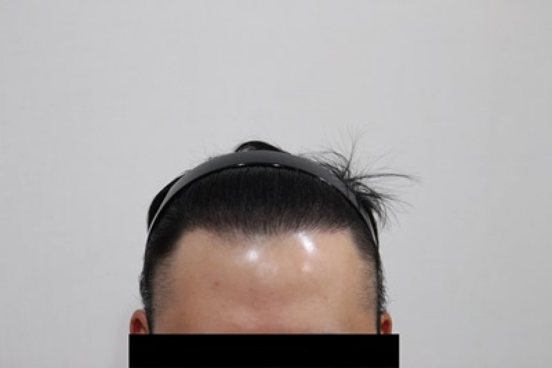ㅇㄱ007-20170510-153703.JPG