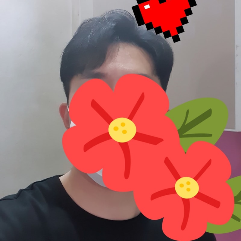 6.수술8개월차.jpg