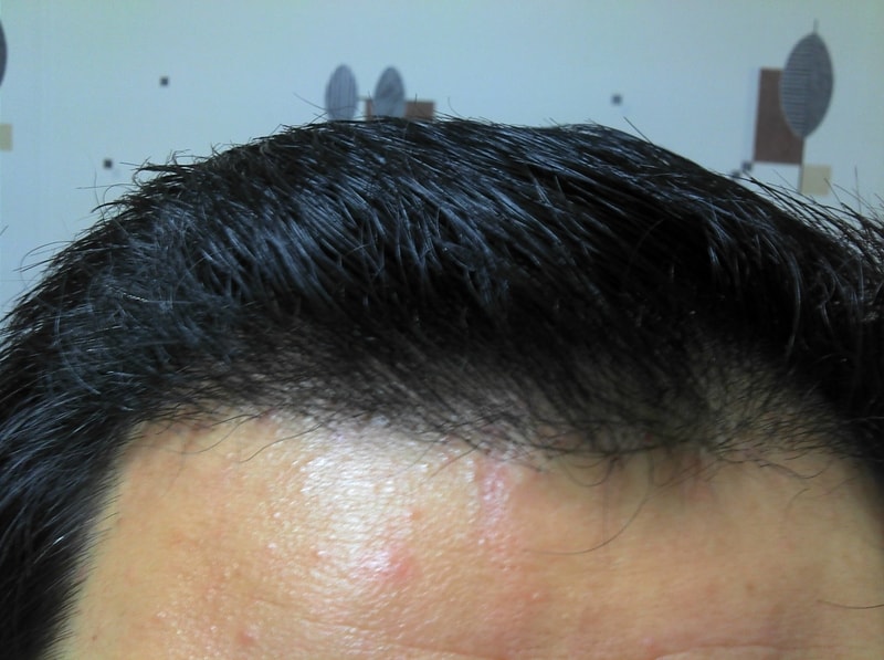 2013-12-05_5개월.jpg