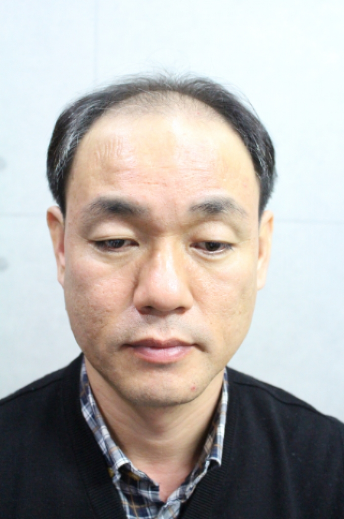 수술전모습2.PNG