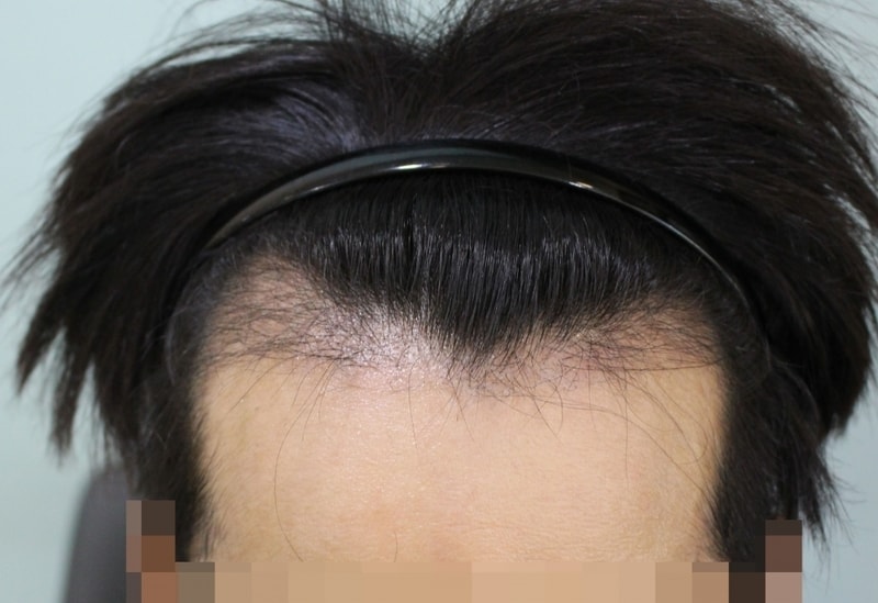 정면위.jpg