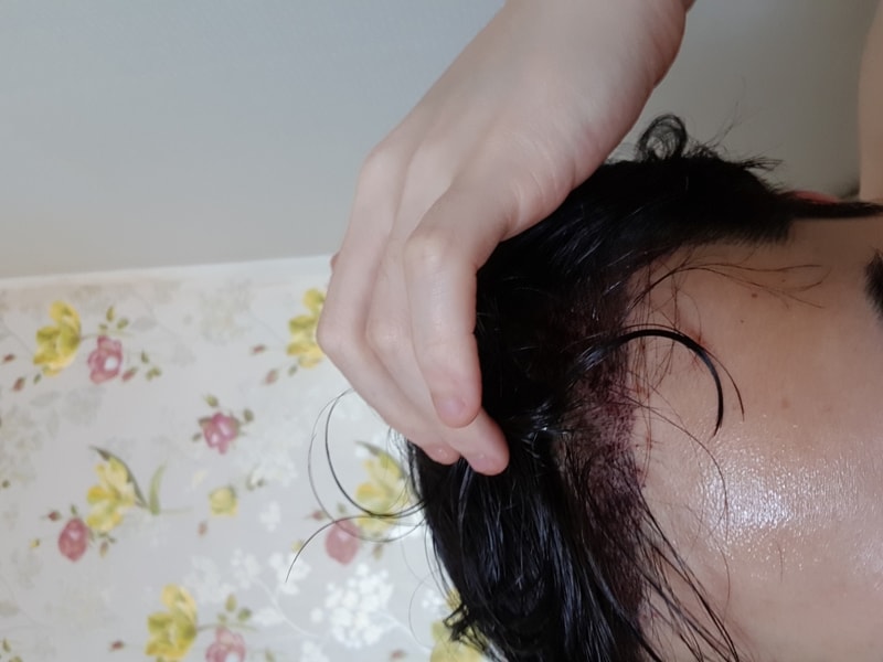 Review of Gwangju Apgujeong Mobiang Surgery