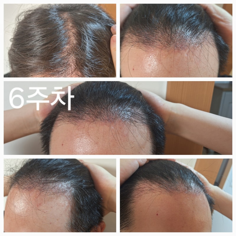 이식6주차.jpg