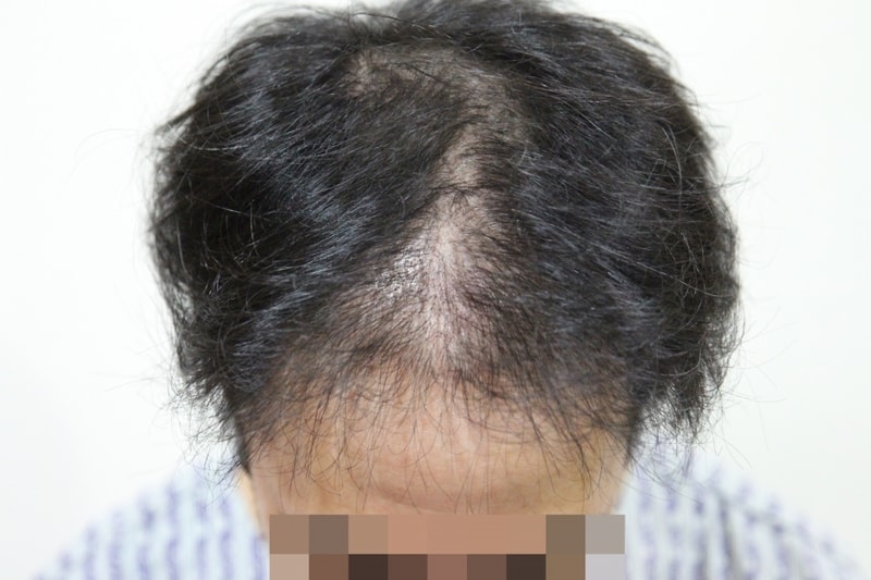 정수리1.jpg