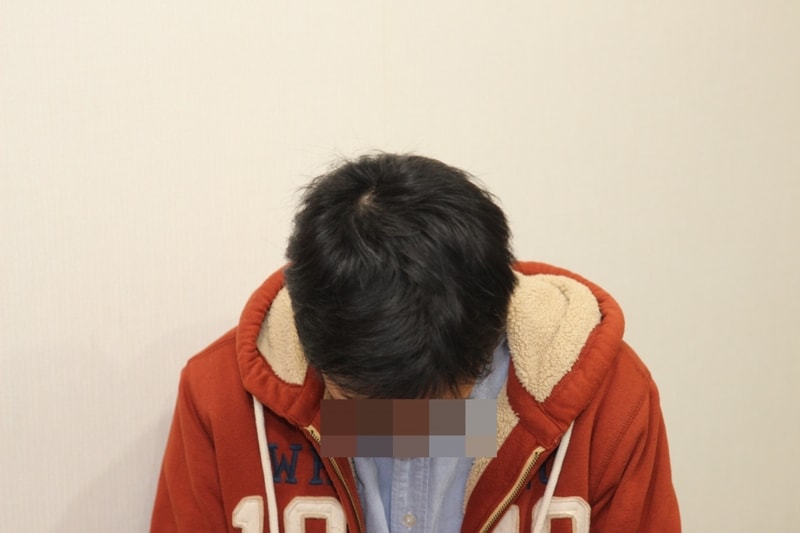 정수리3.jpg