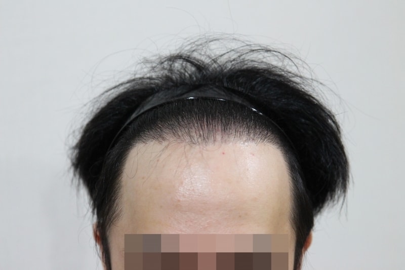 정면.jpg