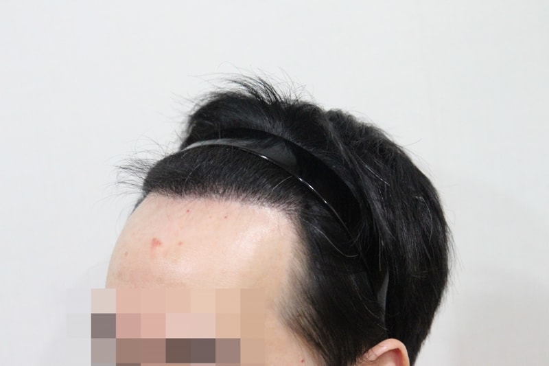 우측1.jpg