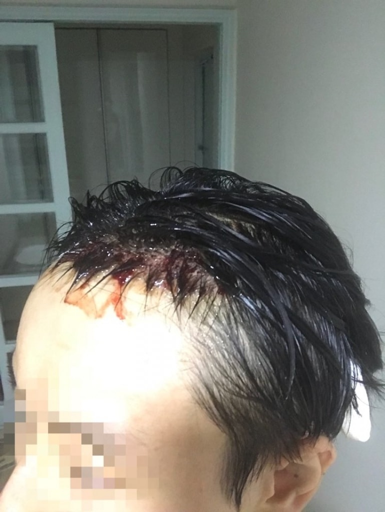 KakaoTalk_20180919_214505781.jpg