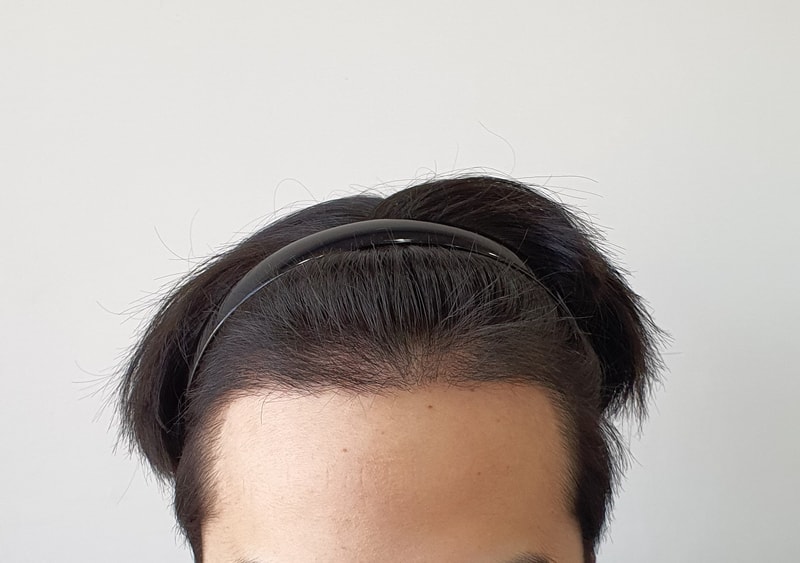 Parental non-cutter 3,000 Mo 4 Months