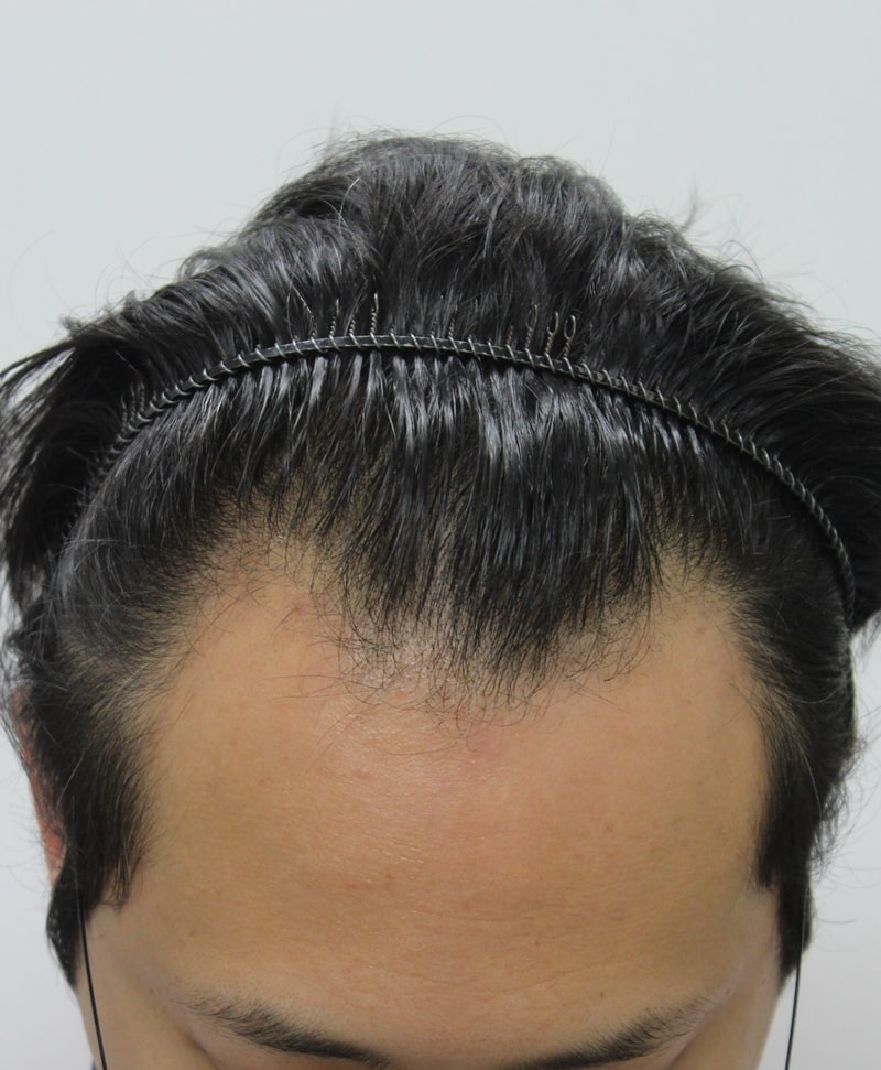 수술전_2.jpg