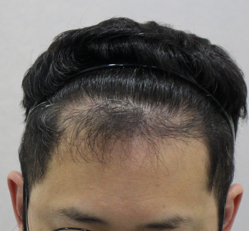 12개월_2.jpg