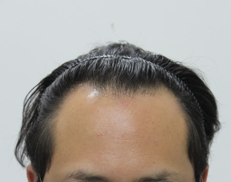 수술전_1.jpg