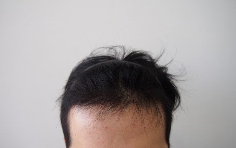 1번.jpg