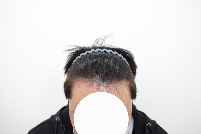 상담전.jpg