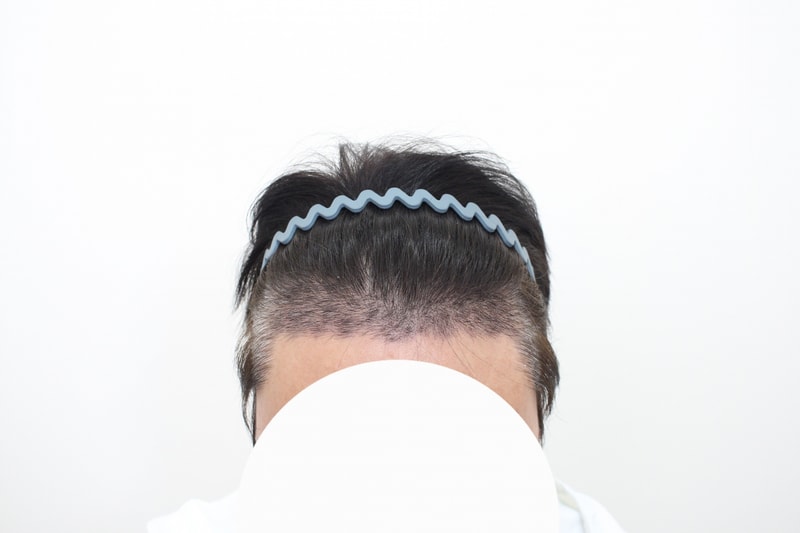 15일후.jpg