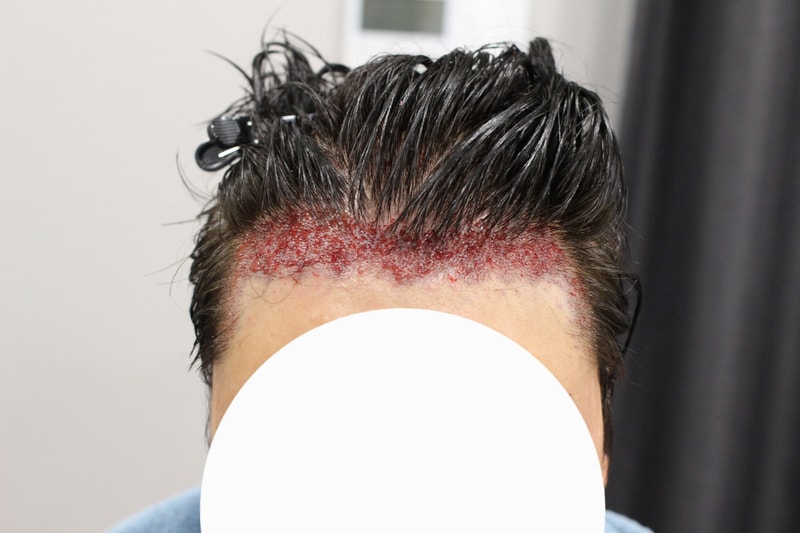이식당일.jpg