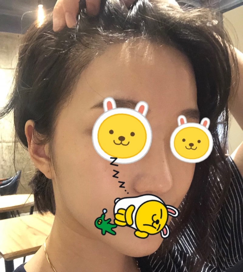 이마사진2.jpg
