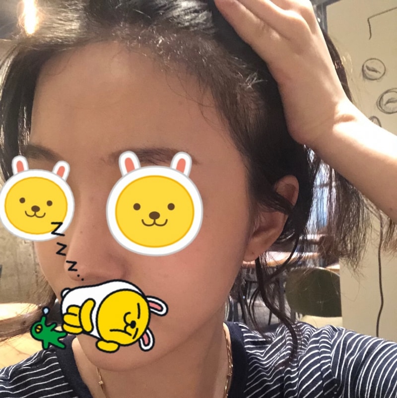 이마사진1.jpg