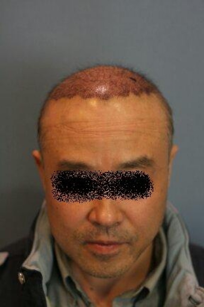 수술다음날2.jpg